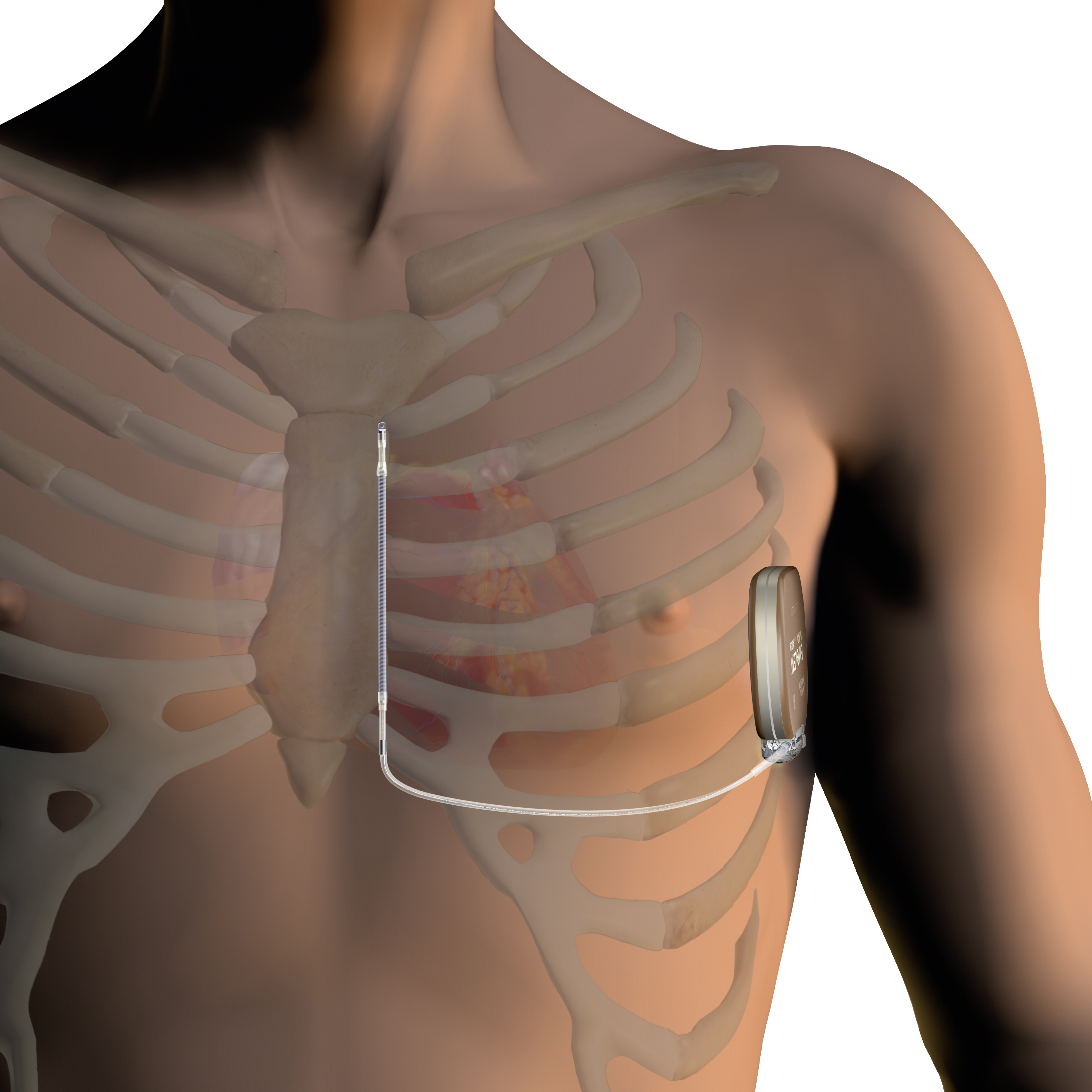 Image Gallery Boston Scientific